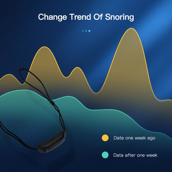 Smart Snore Solution Device